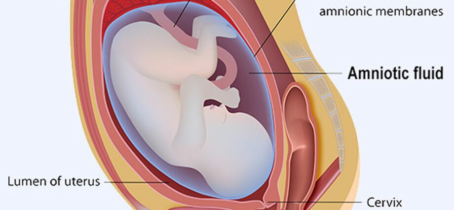 Oligoamnios: when amniotic fluid is lacking