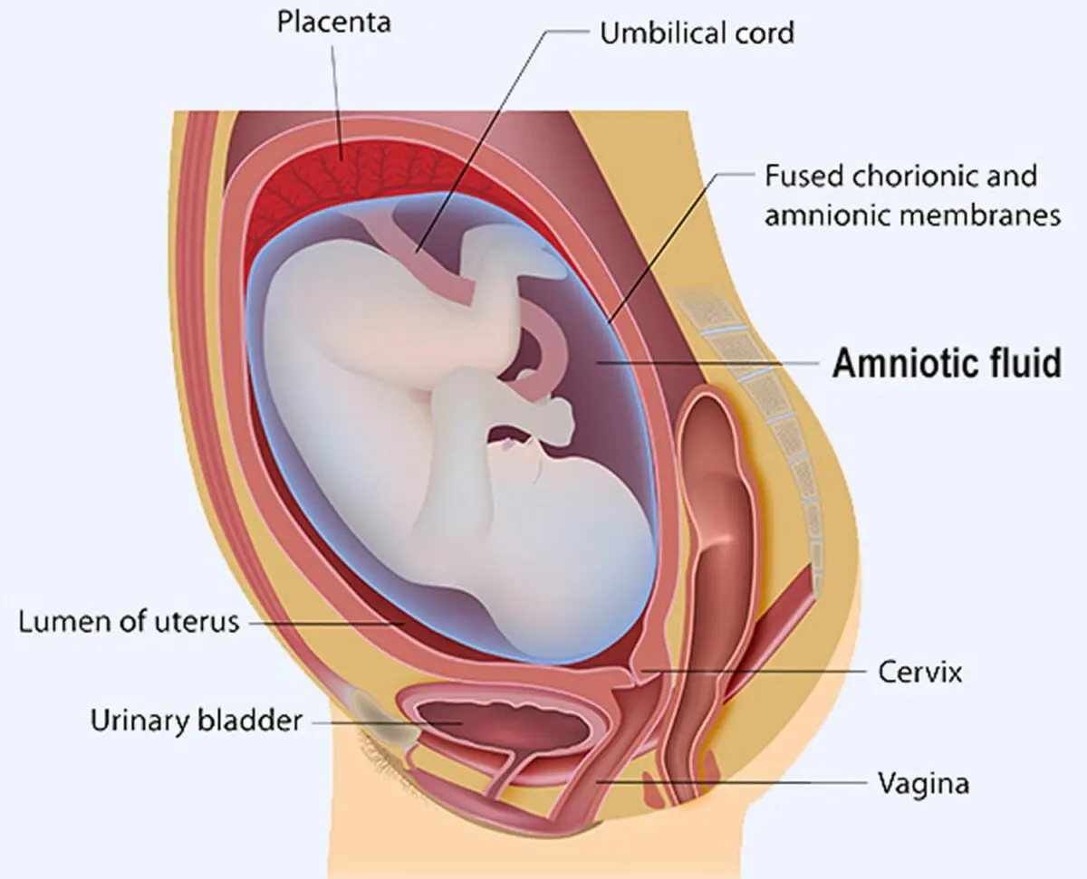 Oligoamnios: when amniotic fluid is lacking