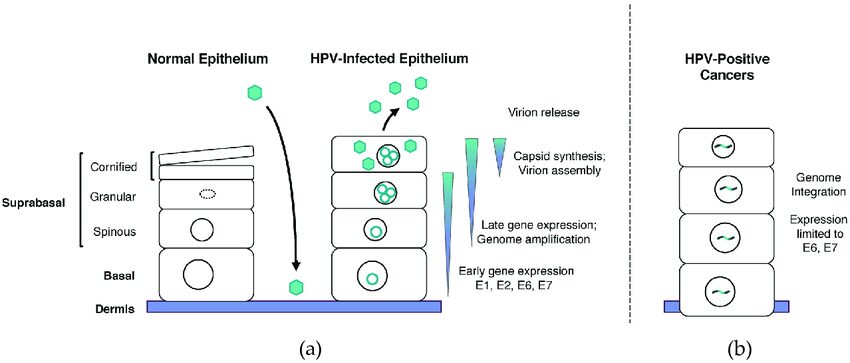 Papillomavirus (HPV virus): it would promote premature childbirth