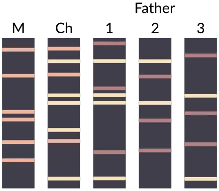 Paternity test: recognition of a child