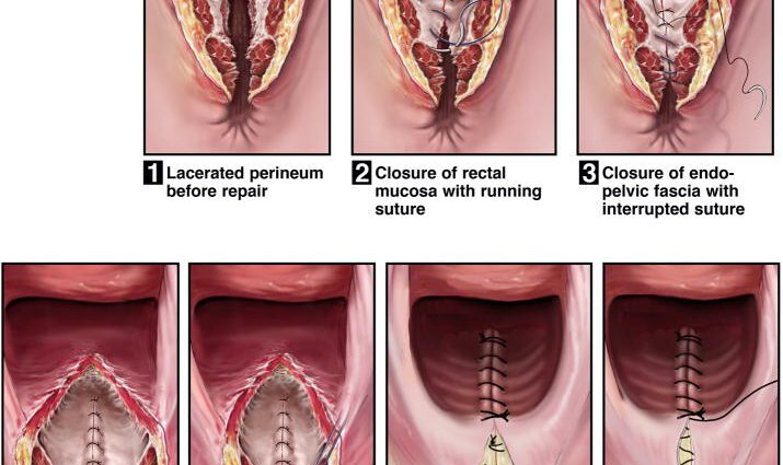 Perineum: I tested three objects for you to take care of it