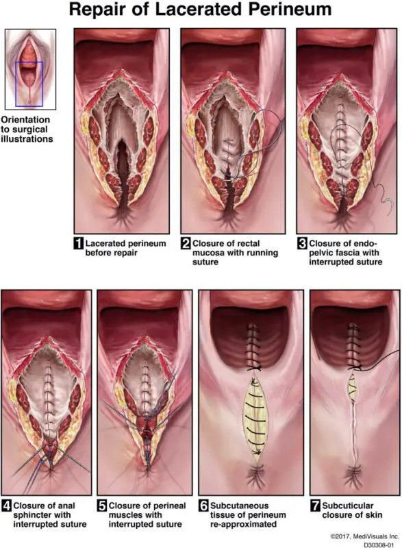 Perineum: I tested three objects for you to take care of it