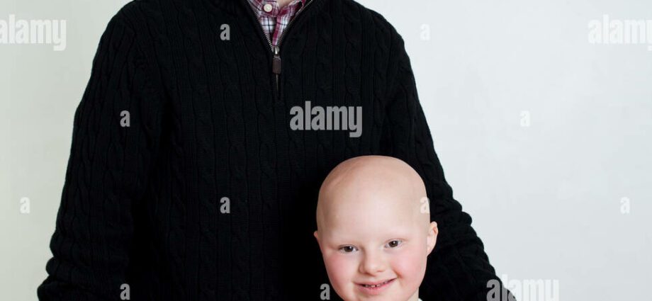 Fotod: isa kujutab Downi sündroomiga poega uskumatul viisil