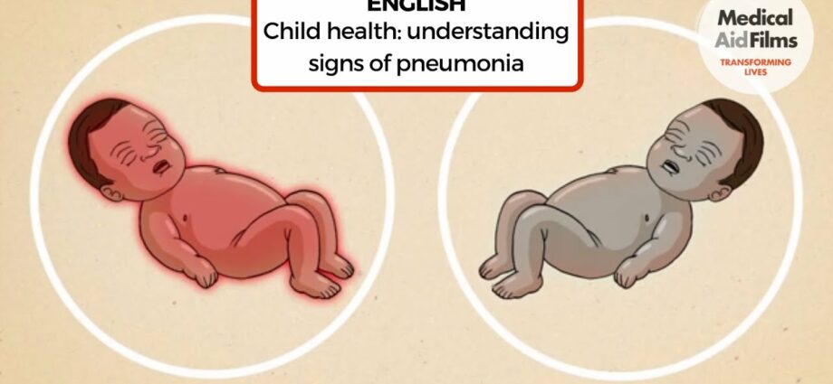 Pneumonia in babies