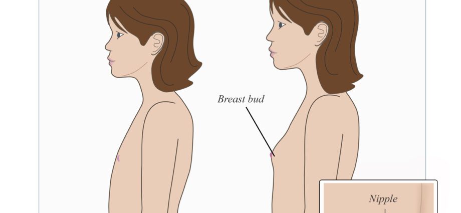 Frühe Pubertät: Meine Tochter hat schon Brüste!