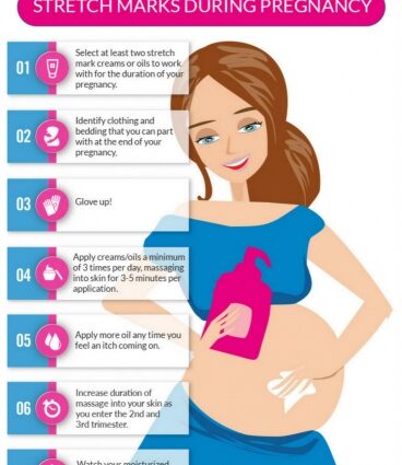 Pregnant, how to avoid stretch marks?