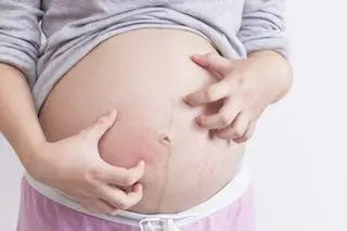 Pregnant: how to fight against skin problems?