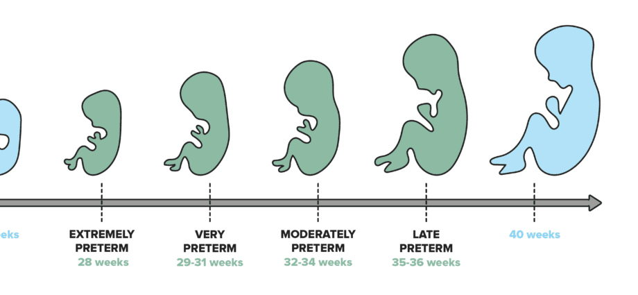 Premature baby: the different types of prematurity