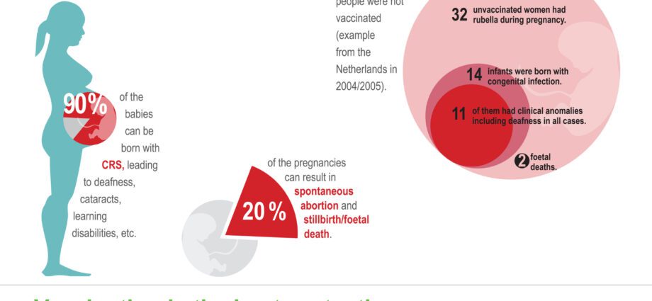 Rubella in pregnant women