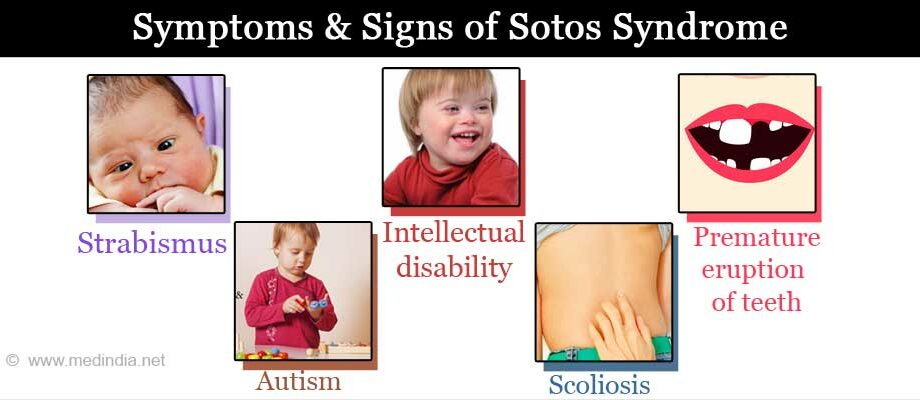 Sotos syndrome: everything you need to know