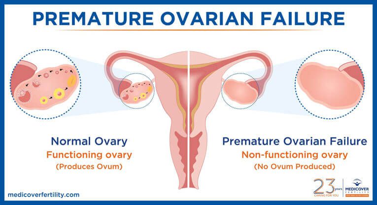 Suffering from ovarian failure, I went to freeze my oocytes