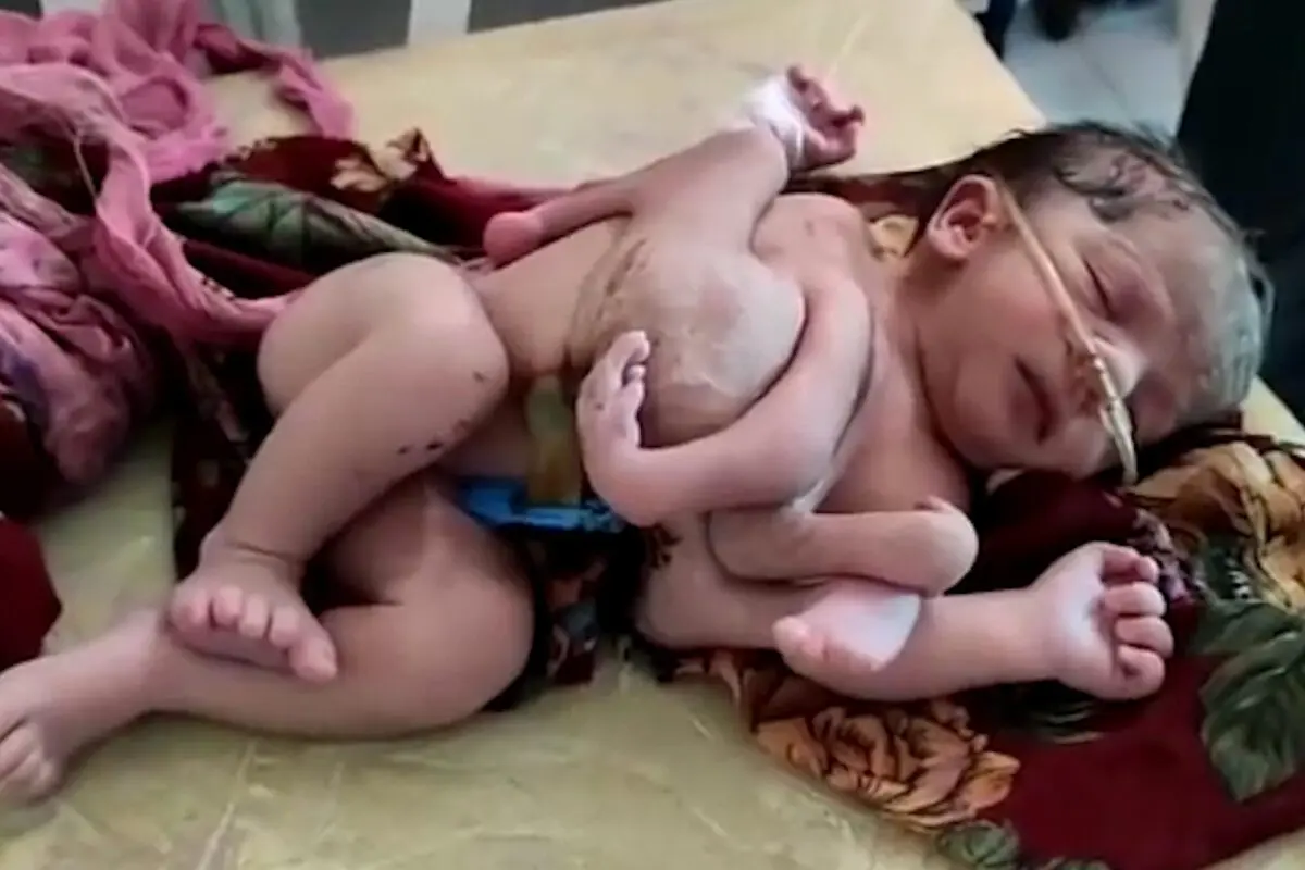 The four-legged in baby, how does it work?