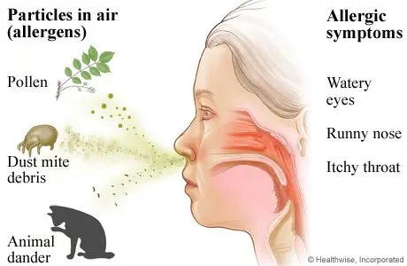 Treat a respiratory allergy