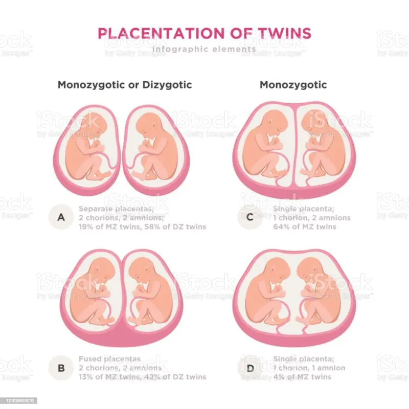 Twin pregnancy: pregnant with twins, what pregnancy follow-up?