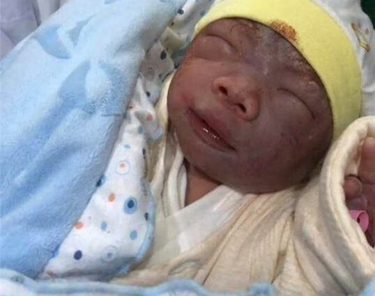 תינוק מכוער בלידה: מה לדעת ואיך להגיב