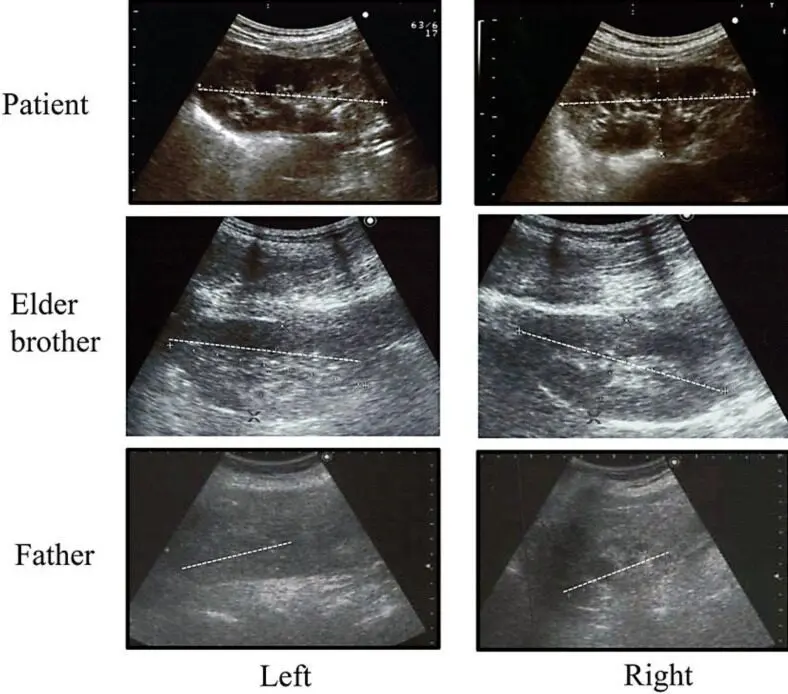 Ultrasounds: should we take the elders there?