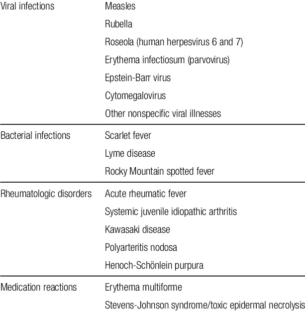 What diseases cause fever in babies?