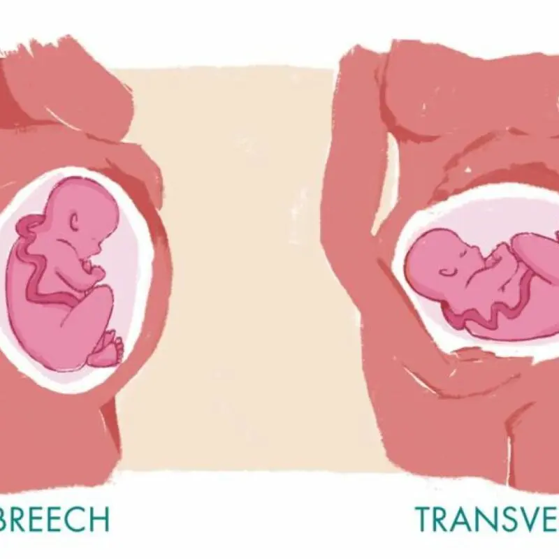 What position is my baby in at the end of pregnancy?