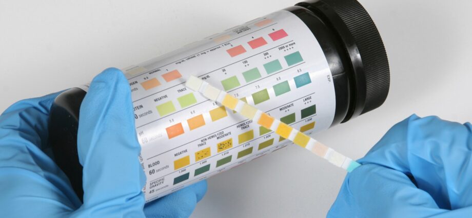 Why is glucose measured in the urine of pregnant women?