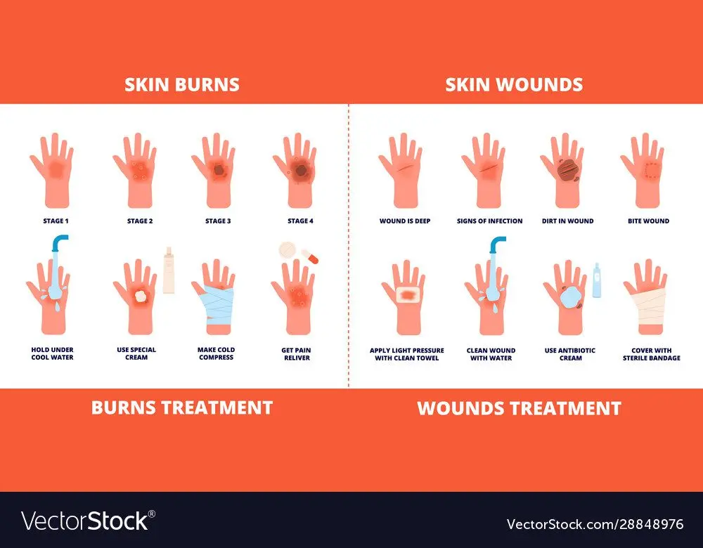 Wounds and burns: first aid measures