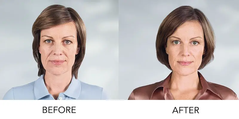 Anti-aging procedures: the most effective methods