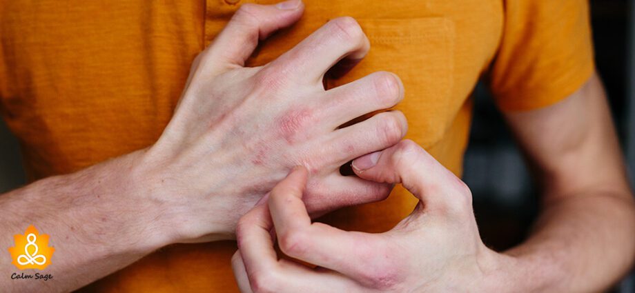 Dermatilomania: how to calm your hands