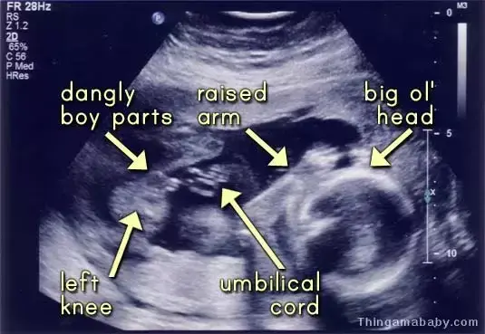 Find out the gender of your unborn child