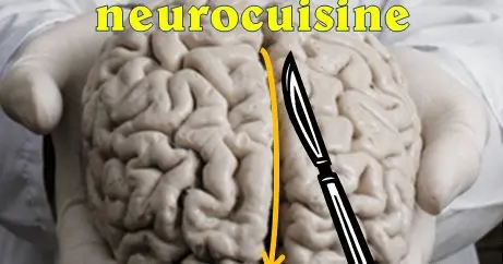 Gluttonous brain