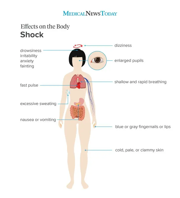 How do shock photos affect us?