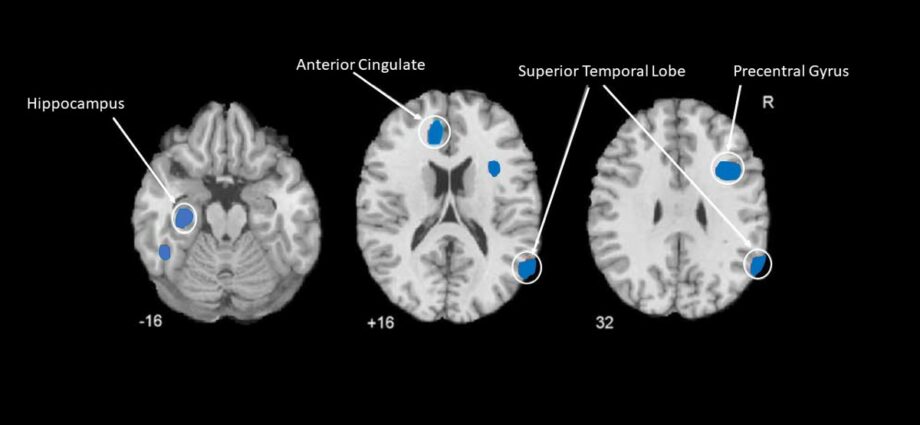 How does the brain generate religious experiences?