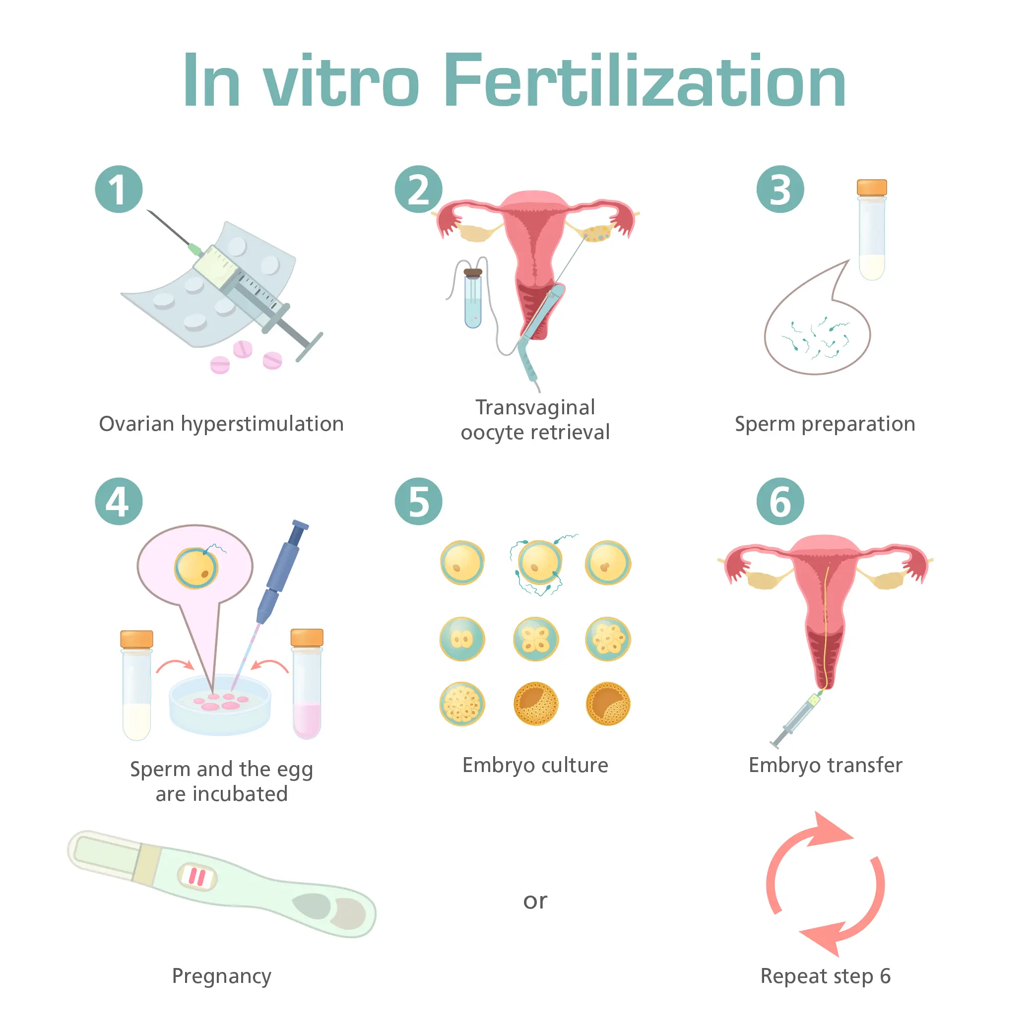 IVF: update on this method of assisted reproduction