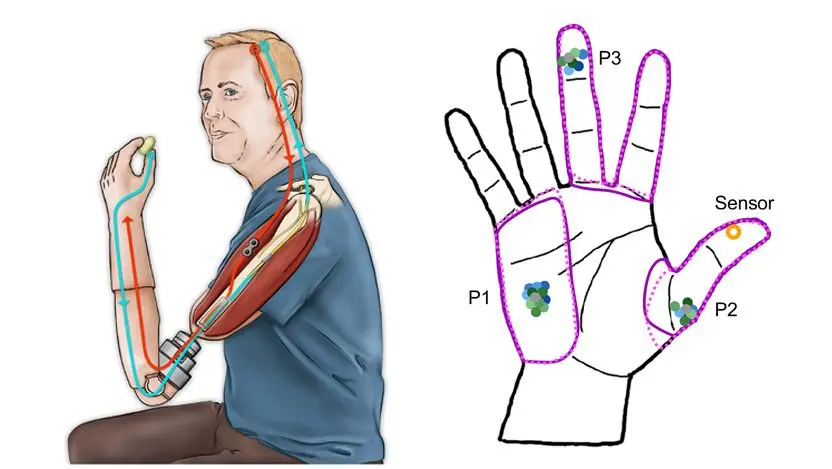 Neuroprosthetics capable of touch