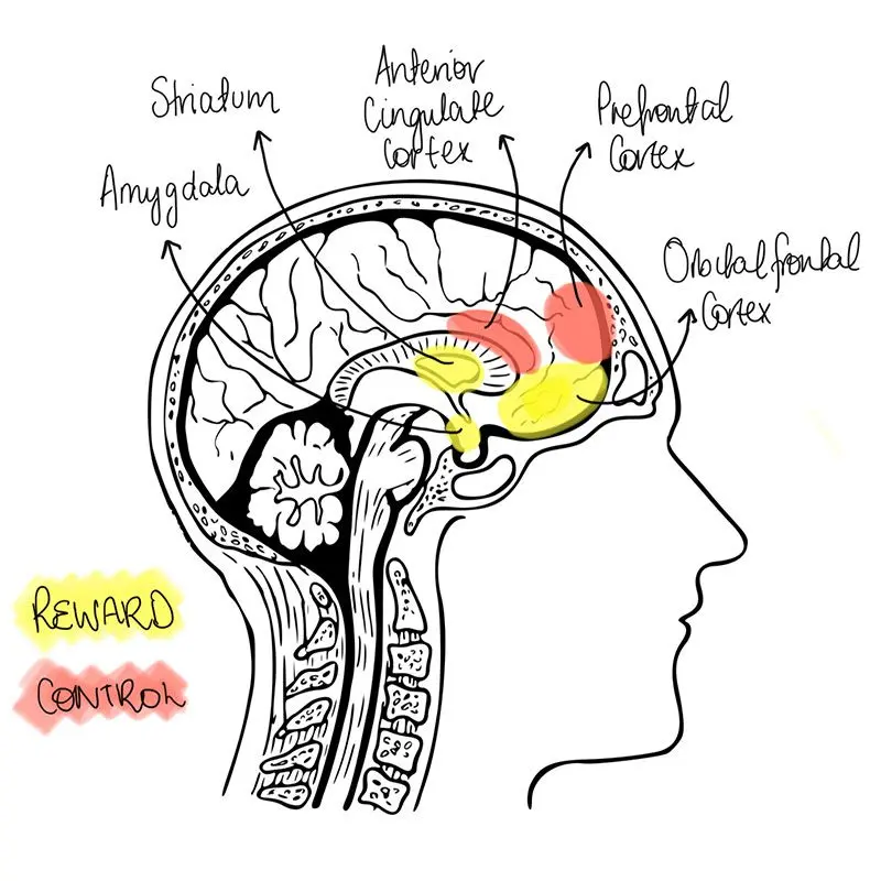 Overeating linked to brain malfunctions