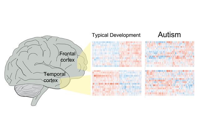 People with autism develop brains that are &#8216;extremely masculine&#8217;