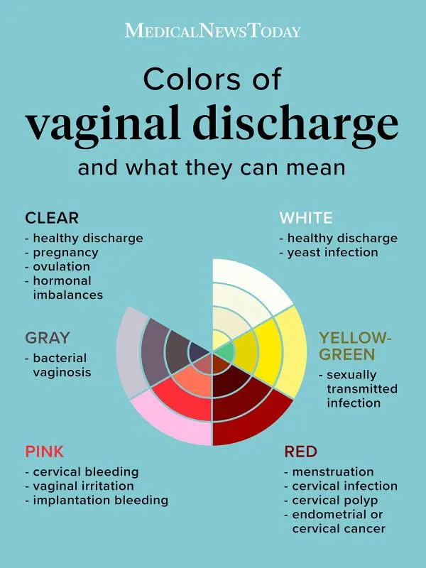 Vaginal discharge: what white discharge and brown discharge indicate