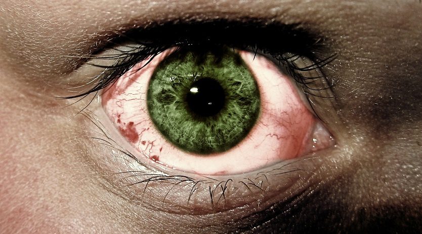 What to do if red eyes are caused by a hangover