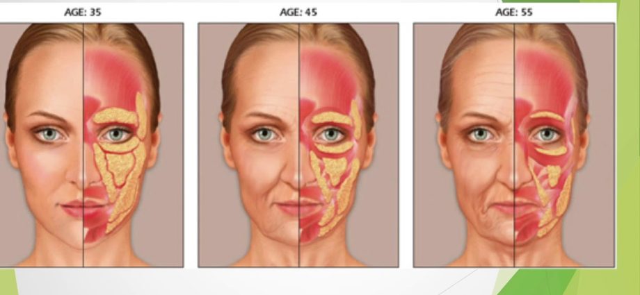 Aging naturally: how to refuse &#8220;beauty shots&#8221;