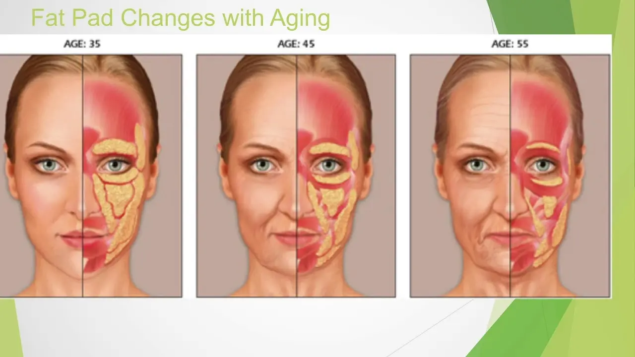 Aging naturally: how to refuse &#8220;beauty shots&#8221;