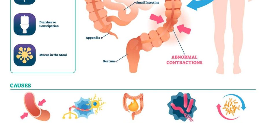 Irritable Bowel Syndrome: Popular Myths and Actionable Solutions