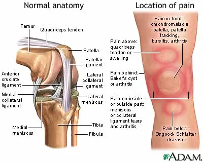 Knees hurt: what is the reason?