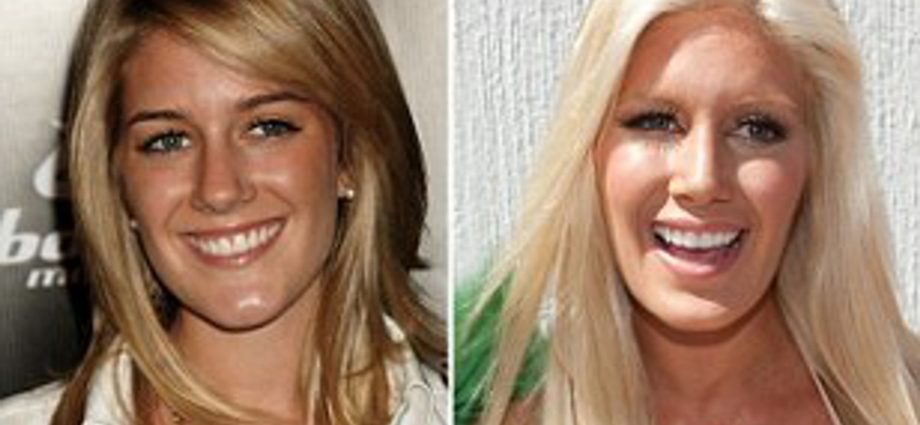 &#8220;Plastic surgery changes me for the better&#8221;