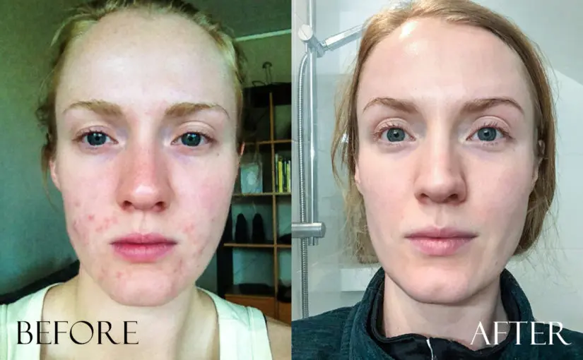 Skin beauty after vacation: care rules