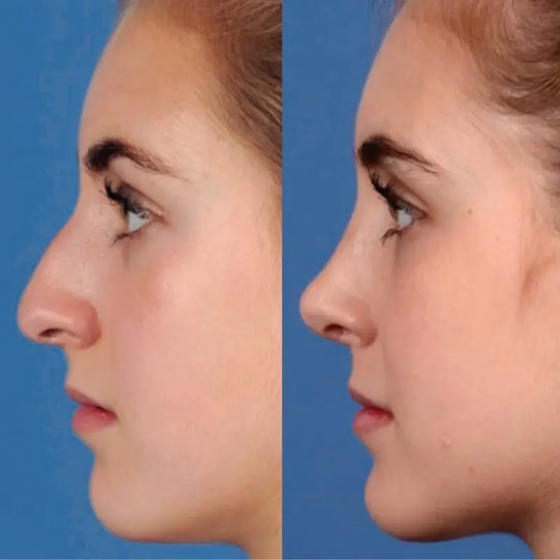 Why plastic surgery is not for everyone who dreams about it?