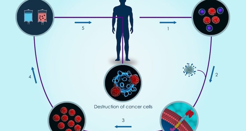 5 Modern Cancer Treatments: What to Hope for in the 2020s