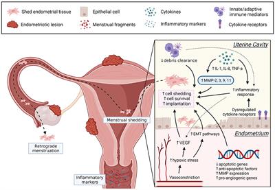 Endometriose, Myome, Entzündungen: Wie und warum «weibliche» Krankheiten entstehen