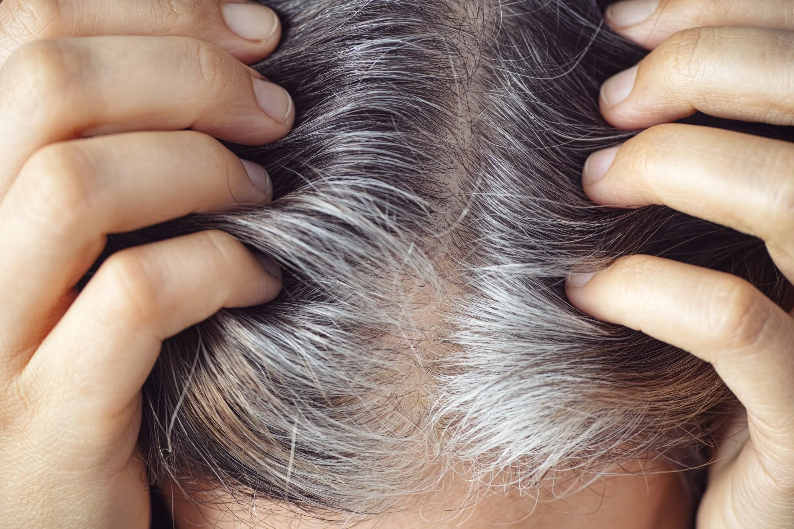 «Finally, I’m turning gray!» and other pleasant aging changes