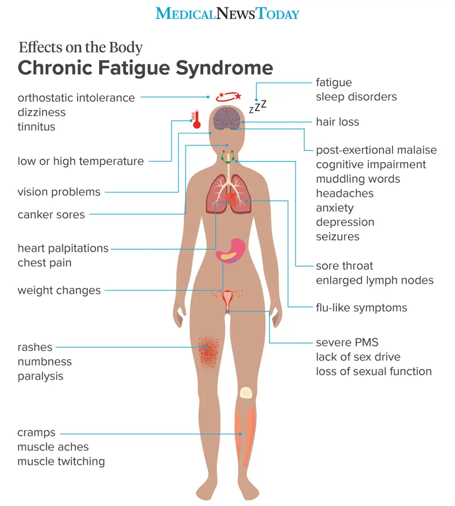 How to get rid of chronic fatigue if the first symptoms appear