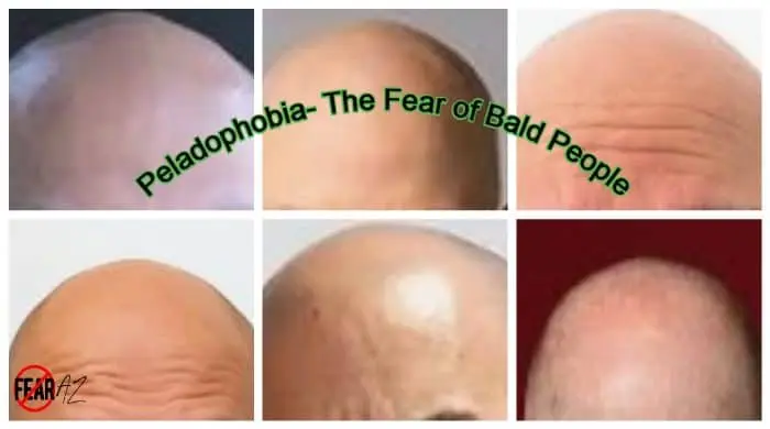 How to get rid of Peladophobia — fear of baldness?