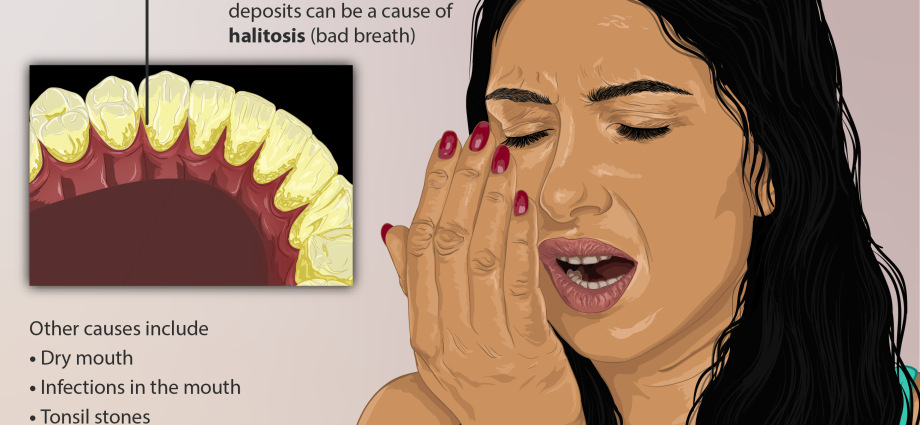 Not only bad breath: psychologists have named 11 factors for a failed date