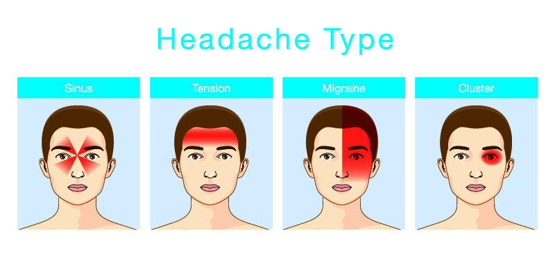 ဤသည်မှာ အကျိတ်ဖြစ်ပြီး၊ ၎င်းသည် ခေါင်းတစ်ခြမ်းကိုက်ခြင်း (migraine) ဖြစ်သည်- ခေါင်းကိုက်ခြင်း အမျိုးအစား (၆) မျိုးကြား ခွဲခြားနည်း